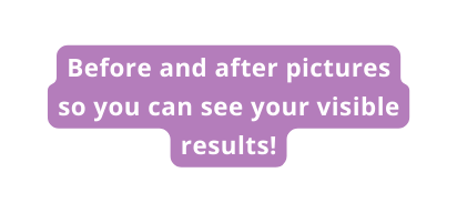 Before and after pictures so you can see your visible results
